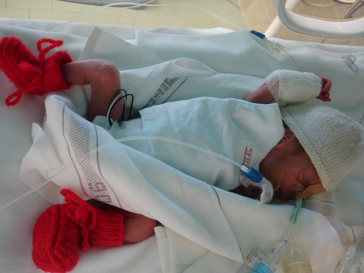 Gastbeitrag zum Welt-Frühgeborenen-Tag: "Mein Sohn wog bei der Geburt gerade mal 900 Gramm" 2 dsc00902