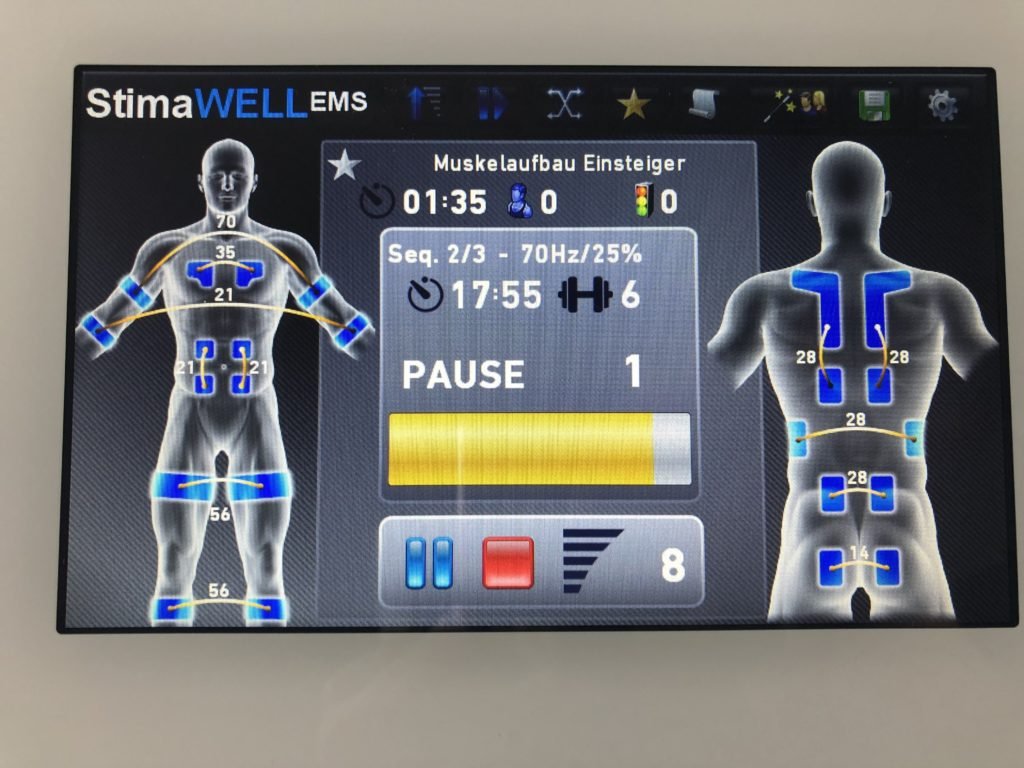 Cooler als im Fitnessstudio: Wir testen den Elektrodenanzug von StimaWell für zu Hause 4 Stimawell8