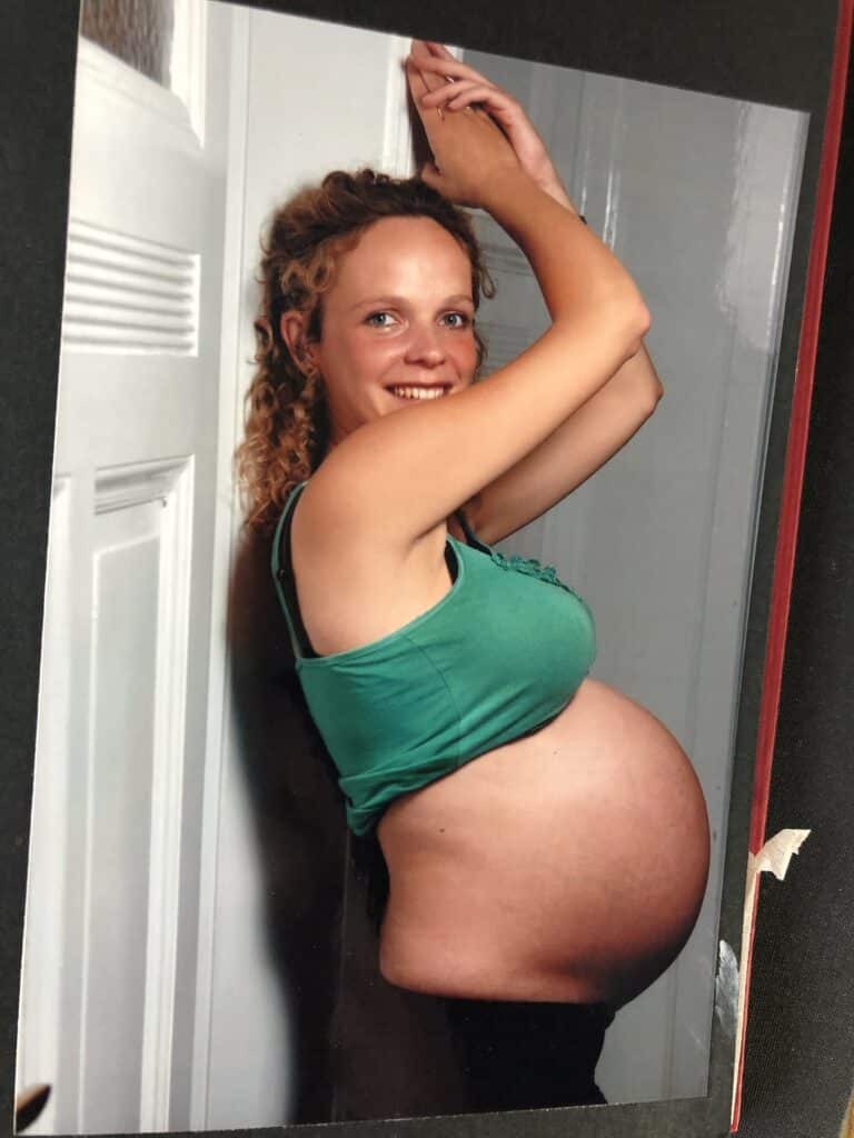 Bindegewebe und gute Pflege: Hattet ihr Schwangerschaftsstreifen? 2 FotoUndGeschichteA