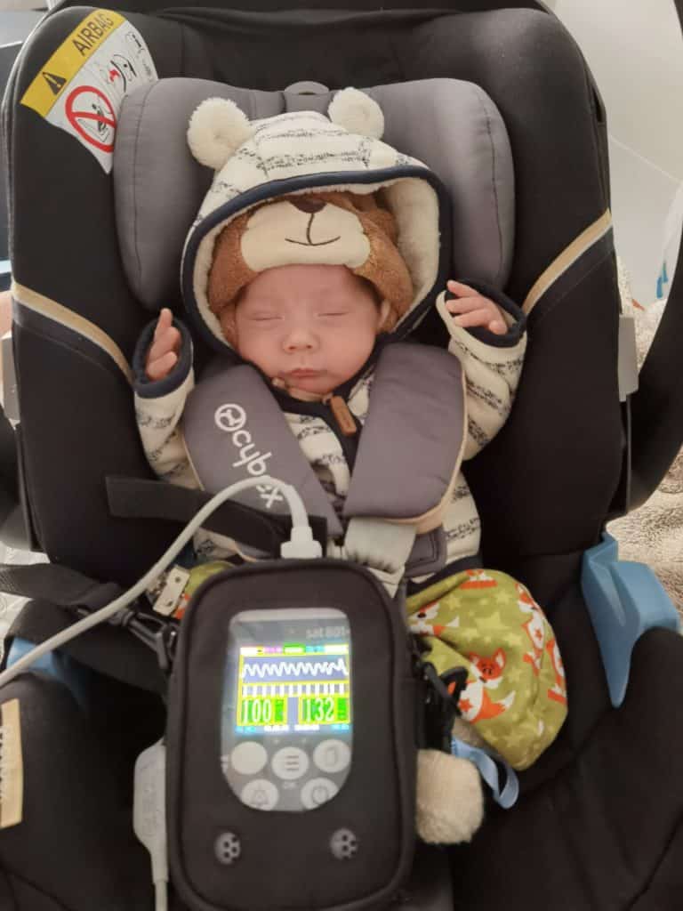 Kaiserschnitt auf der Corona-Intensivstation: So geht´s Miri 6 17075