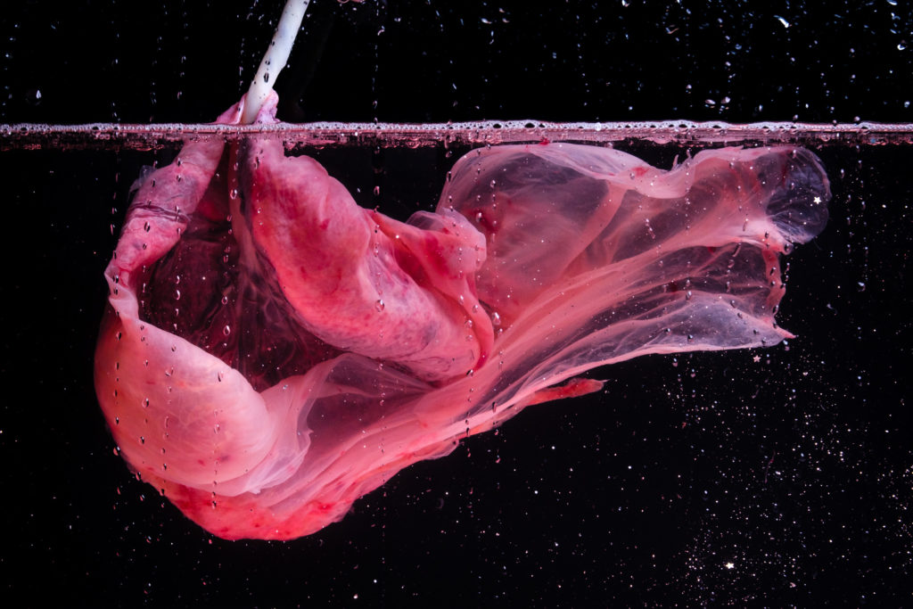 Plazenta Power: Sollte man den Mutterkuchen wirklich verzehren? 3 Plazenta Power