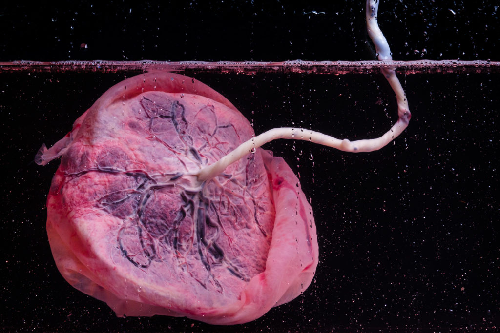 Plazenta Power: Sollte man den Mutterkuchen wirklich verzehren? 4 Plazenta Power