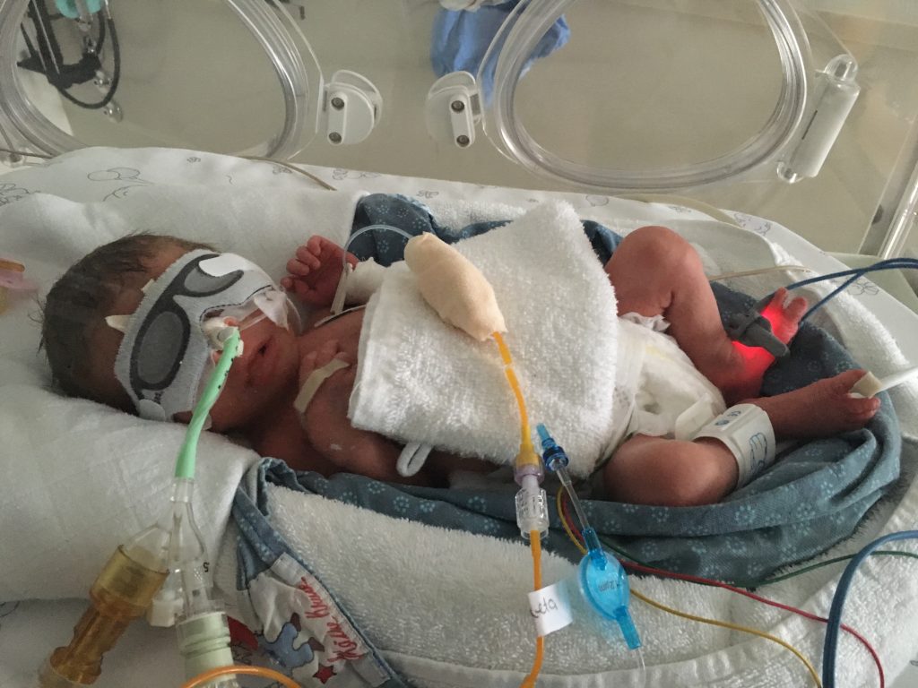 3 Geburten: So unterschiedlich kamen meine Kinder zur Welt 2 3 Geburten