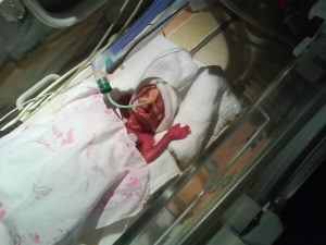 Welt-Frühgeborenen-Tag